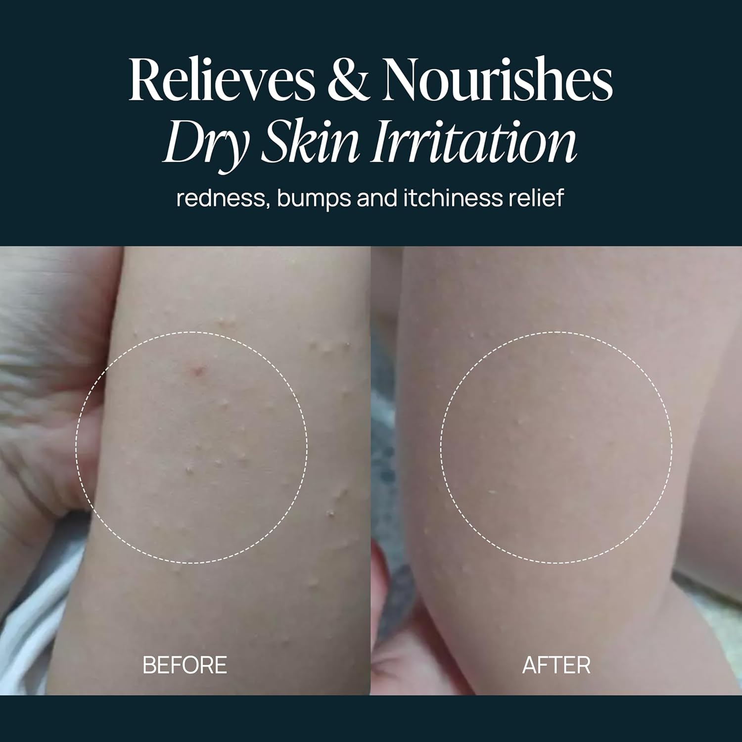 Perfection-P Panthenol Cream, 6.76 Fl. Oz/200ml